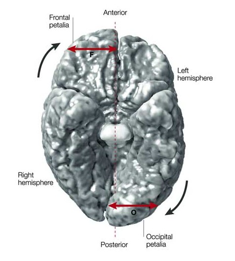 asymmetrical brain