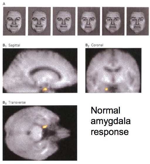 amygdala face processing morris