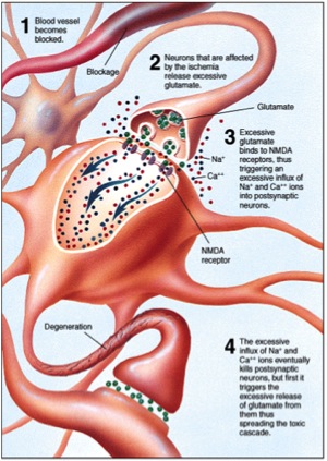 ischemic cascade