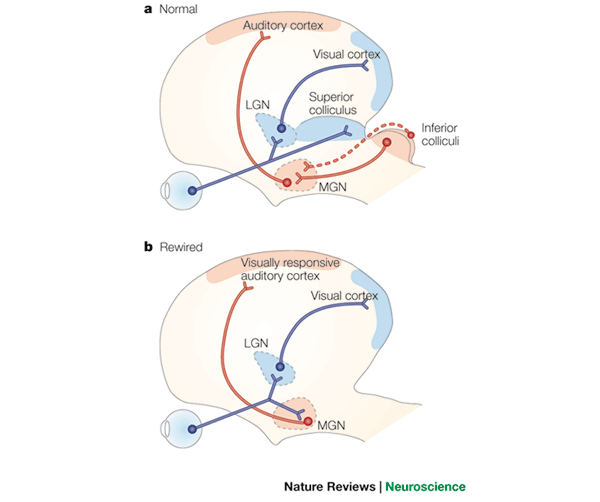 rewiring the auditory cortex