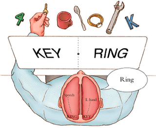 split                  brain patients: saying versus speaking