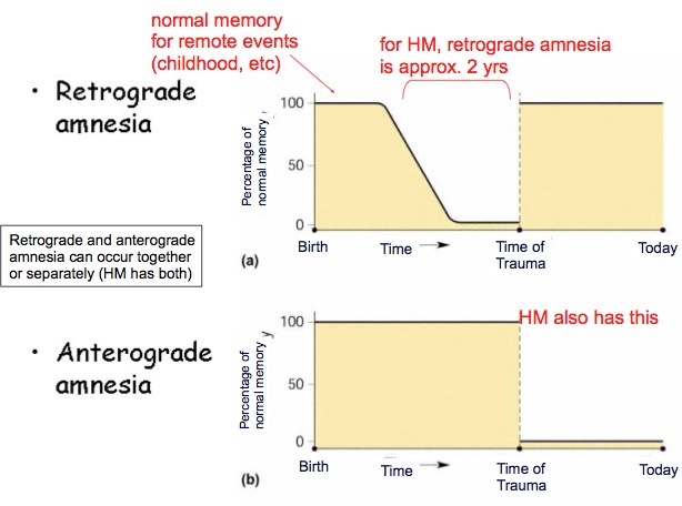 anterograde retrograde memory