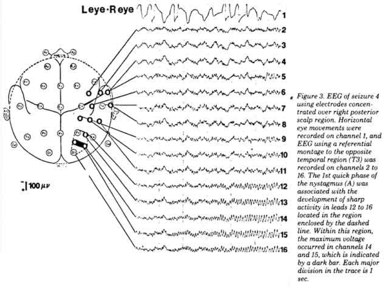 eeg channels