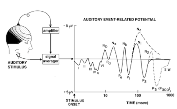 erp auditory