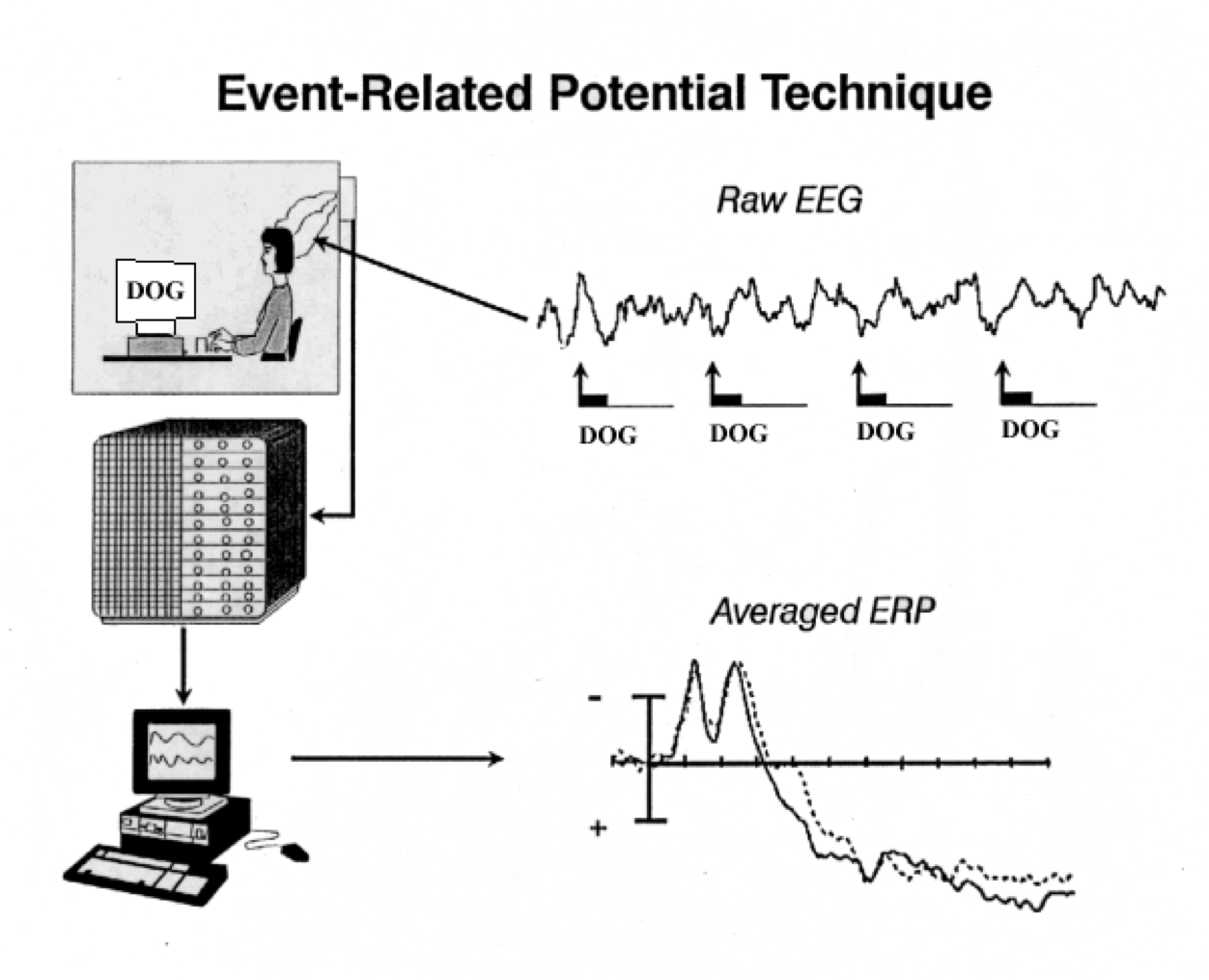 eeg erp