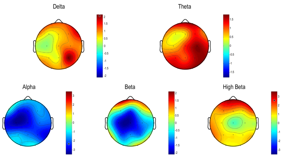 eeg localization