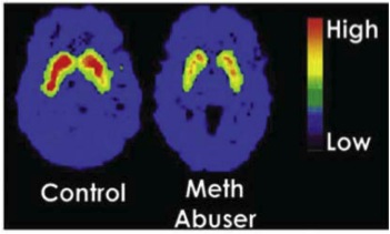 pet drug dopamine