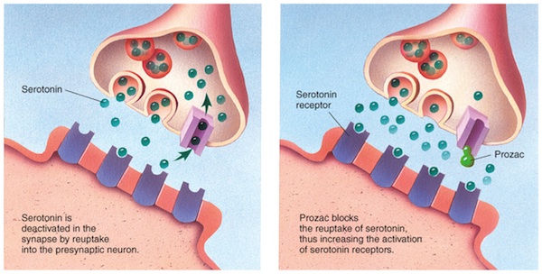 SSRIs