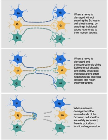 neuronal regeneration